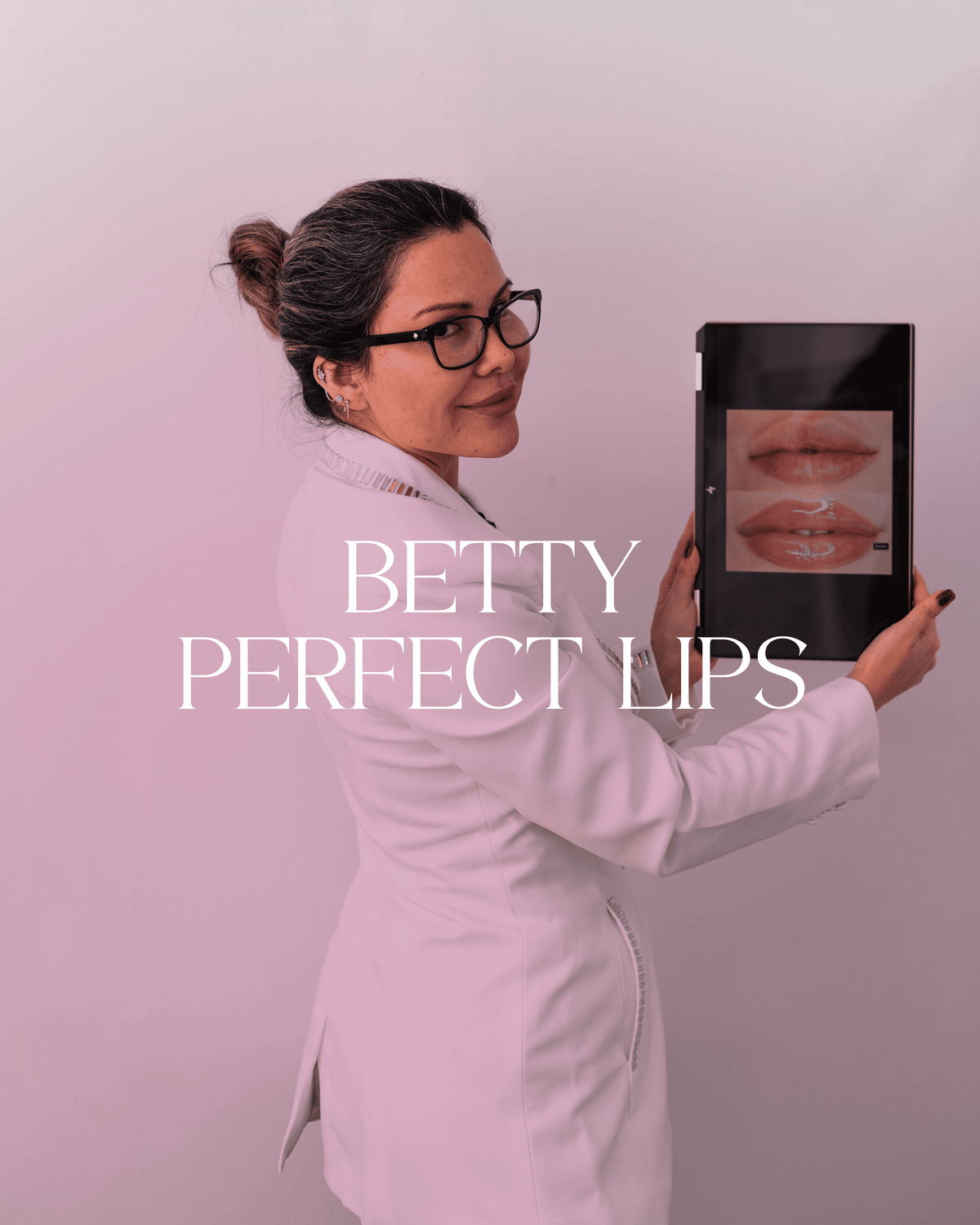 Betty Perfect Lips | Aumento de Labios